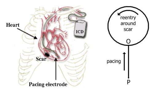 heart diagram apex